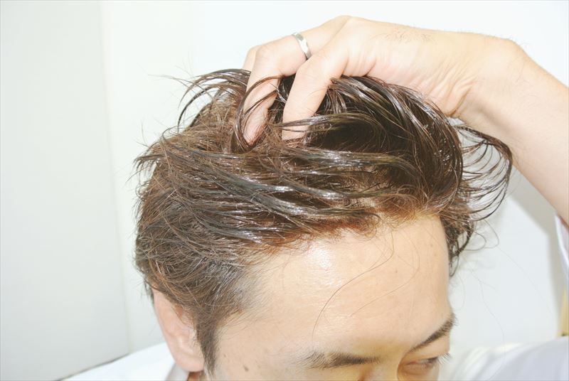 濡れても自然なかつらの生え際