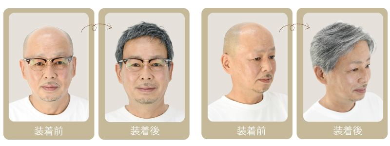装着前 装着後