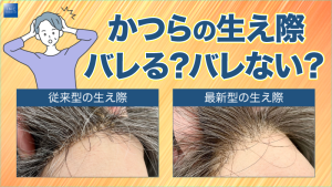 かつらの生え際、バレる？バレない？