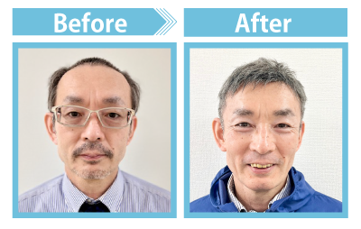Before After