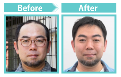 Before After