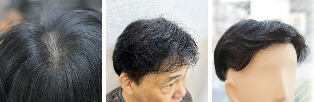 総手植えによる自然な髪の毛の流れ（MFF）