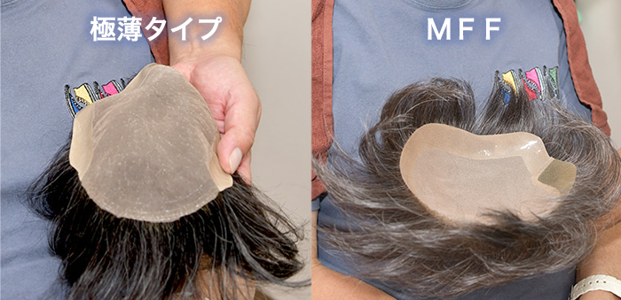 極薄かつらとMFFの比較写真（ベースの安定性）