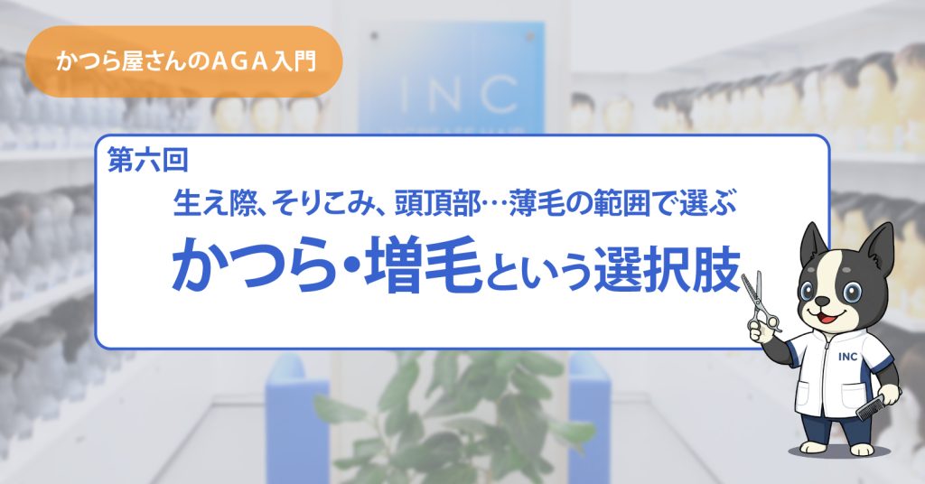 かつら・増毛という選択肢【かつら屋さんのAGA入門⑥】