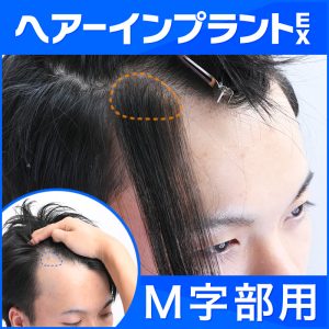ヘアーインプラントEX(M字部用)