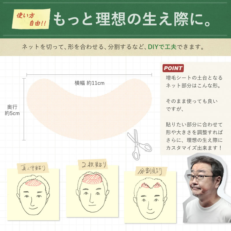 もっと理想の生え際に、DIYで工夫できます。プラージュ