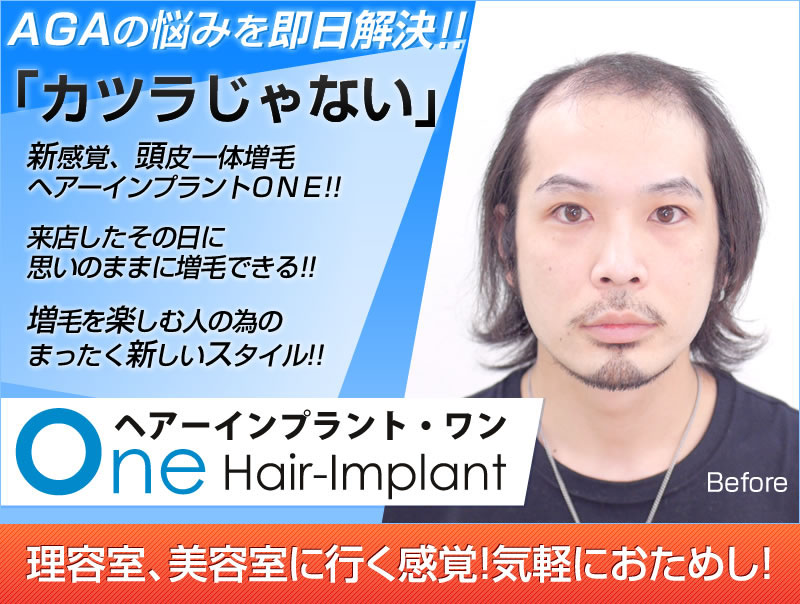 ヘアーインプラント・ワン