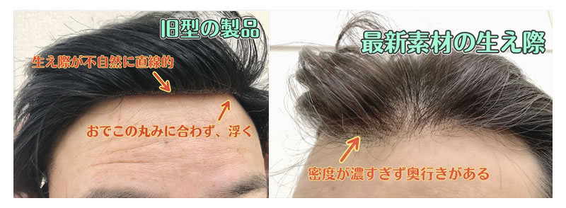 製品紹介 気になる 最新かつらの生え際事情をご紹介 極薄かつらのインクリーズヘアー