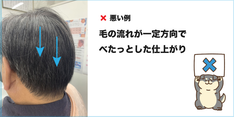 ヘアーインプラントEX 天頂部用 リピーターパック ※装着にはテープかシリコンが必要です