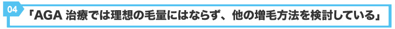 AGA治療ではなく他の増毛方法を検討している