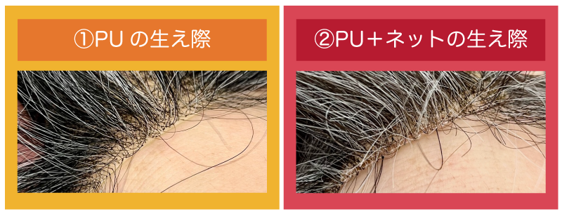 ①PU（ポリウレタン樹脂）だけのかつらの生え際の写真
②PU＋ネットのかつらの生え際の写真