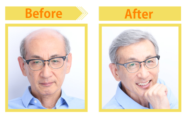 before after01