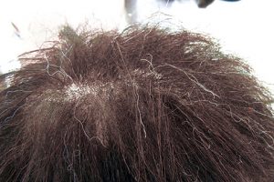 静電気と乾燥で傷んだウィッグ