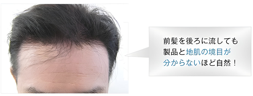 ナノスキン比較