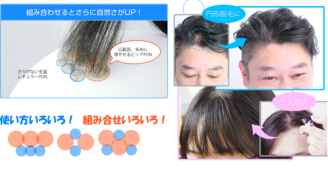 レギュラーPONとビッグPONの2種類を比較、使い方、組み合わせ色々のクイックＰＯＮ、クイックポン愛用者の声