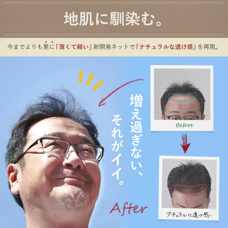 増え過ぎないのがいい、髪フラージュは地肌に馴染み、ナチュラルな透け感を再現